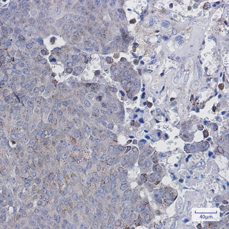 Recombinant Adipose Triglyceride Lipase Monoclonal Antibody - 2