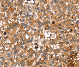 STAR Polyclonal Antibody - 2