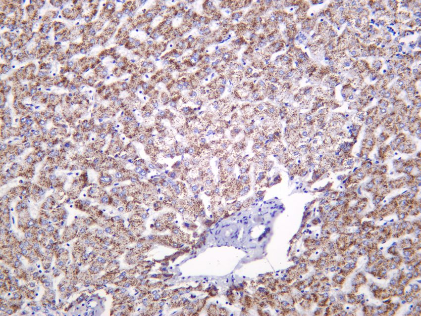 Recombinant ACOX1/AOX Monoclonal Antibody - small - 4