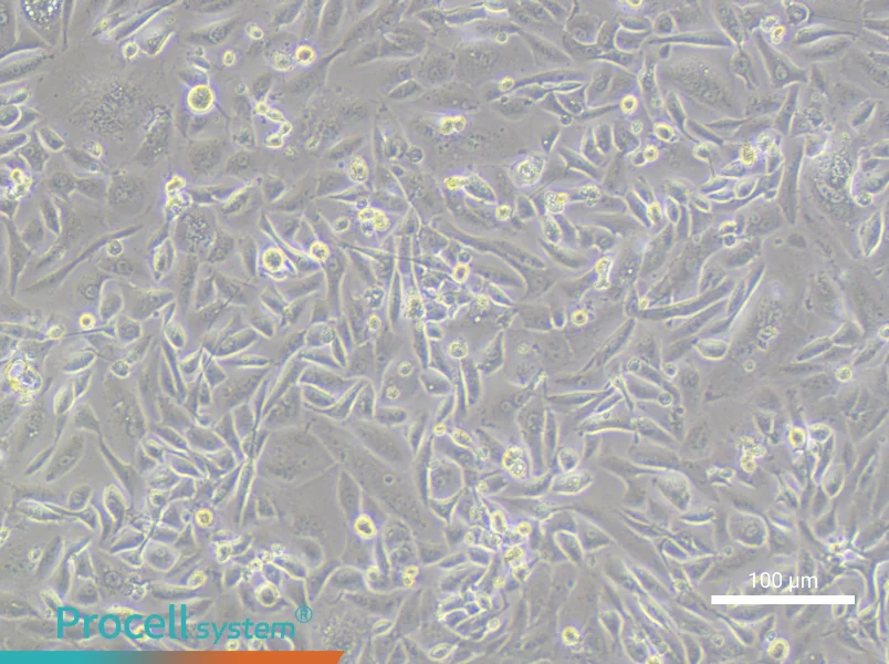 OV56 Cell Complete MediumOV56 Cell Complete Medium - 2
