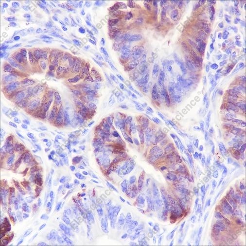 Recombinant Serum Amyloid P/SAP Monoclonal Antibody - 2