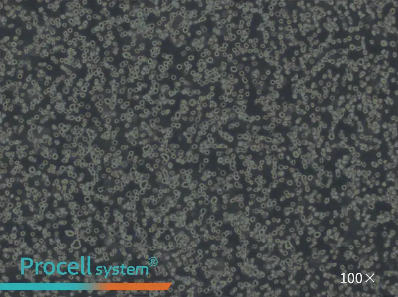 Karpas-299 Cell Complete Medium - 1