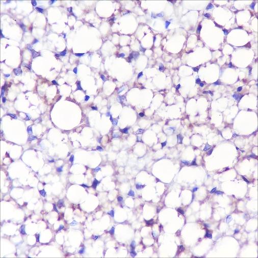 Recombinant UCP1 Monoclonal Antibody - small - 2