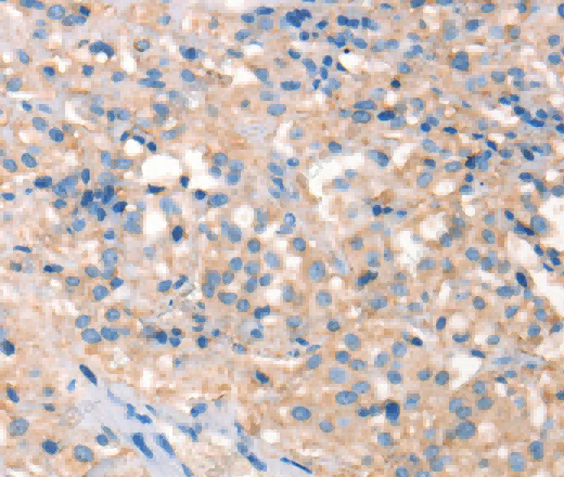 PRPS1/2/PRPS1L1 Polyclonal Antibody - 2
