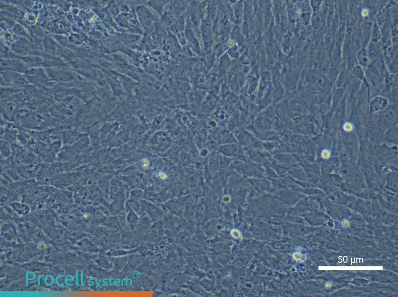 Rat Scleral Fibroblast Complete Medium - 5