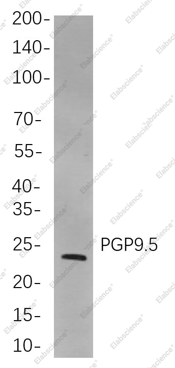 Recombinant PGP9.5 Monoclonal Antibody - 1