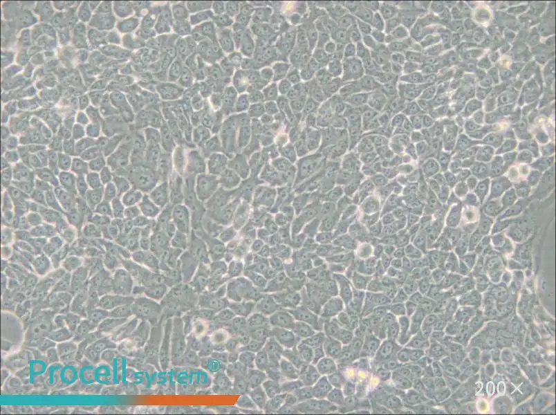 Detroit 562 Cell Complete Medium - 4