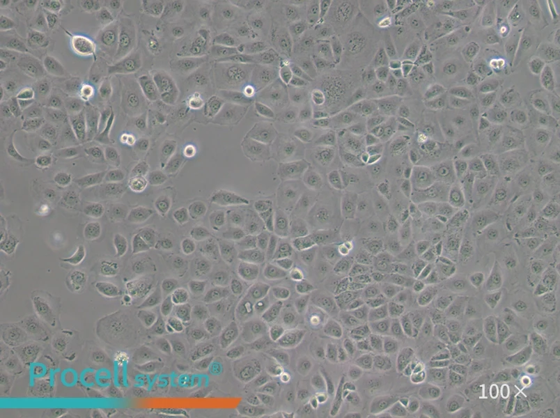 NIH:OVCAR-3 [OVCAR3] Cell Complete Medium - 3
