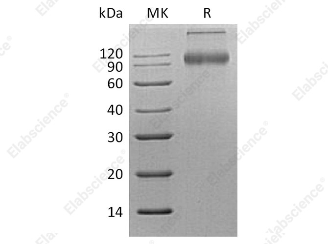 Recombinant Human CD200R1 Protein (Fc Tag) - 1