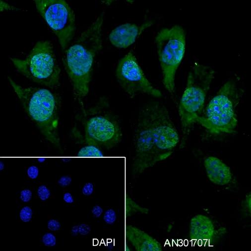 Recombinant S100A1 Monoclonal Antibody - small - 4