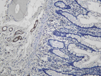 Recombinant CD239 Monoclonal Antibody - 1