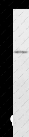 KDM8 Polyclonal Antibody - 1