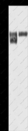 ITGB1 Polyclonal Antibody - 1