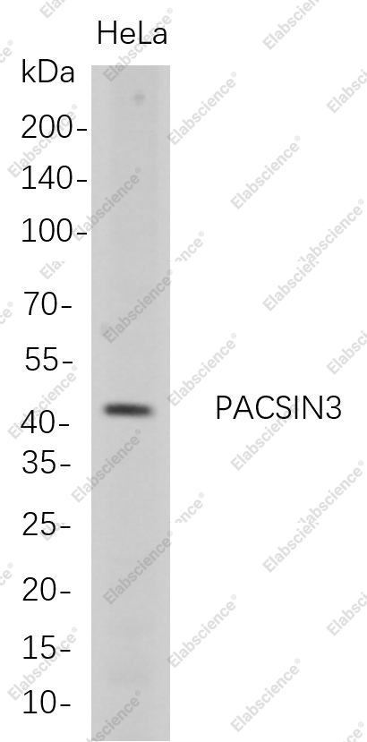 Recombinant PACSIN3 Monoclonal Antibody - 1