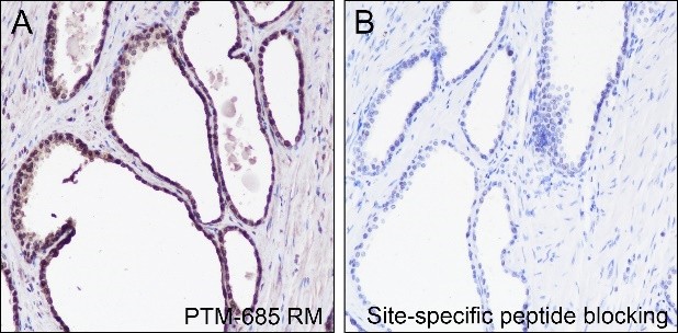 Recombinant Histone H4 (Mono Methyl Lys12) Monoclonal Antibody-searchlist-2