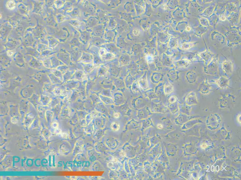 92-1 [Human uveal melanoma] Cell Complete Medium - 6