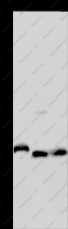 GSTP1 Polyclonal Antibody - 1