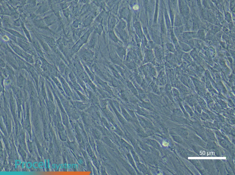 Human Uterine Smooth Muscle Cell Complete Medium - small - 6