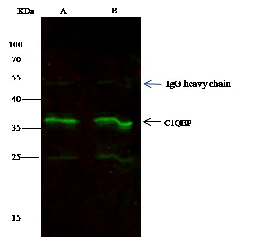 C1QBP/HABP1 Monoclonal Antibody - small - 2