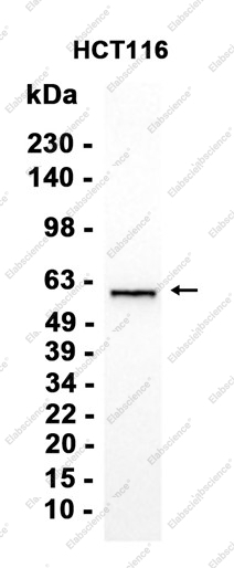 Recombinant DKC1 Monoclonal Antibody - 1