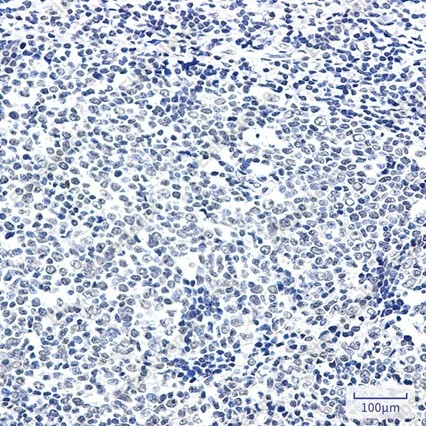Recombinant PTBP1 Monoclonal Antibody - 4