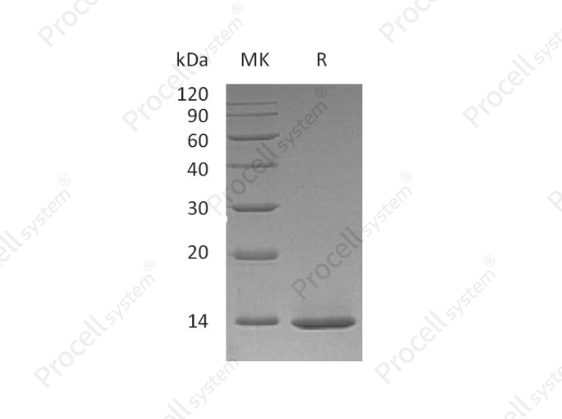 &beta;-NGF/NGF/NGFB/NGF-&beta;, Human, Recombinant