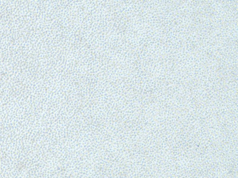 OCI-AML-2 Cell Complete Medium - 2