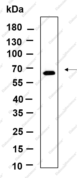 Recombinant Phospho-PERK (Thr980) Monoclonal Antibody - 1