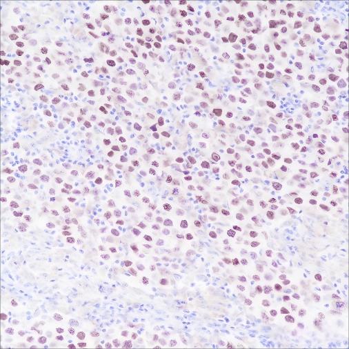 Recombinant SALL4 Monoclonal Antibody-searchlist-1