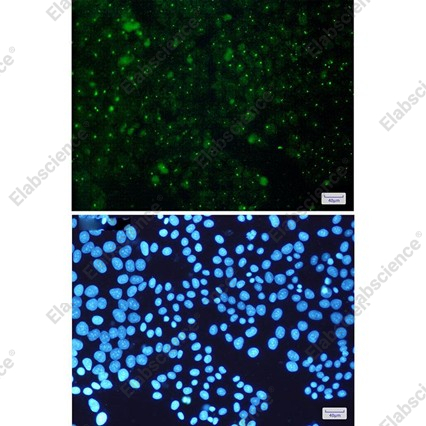 Recombinant Aryl Hydrocarbon Receptor Monoclonal Antibody - 2