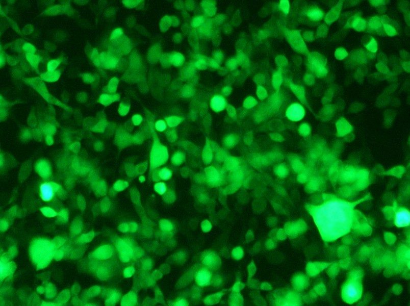 RM-1-GFP Cell Complete Medium - small - 6