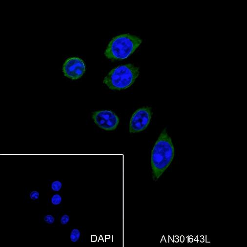 Recombinant Phospho-PTP1B (Ser386) Monoclonal Antibody - small - 4