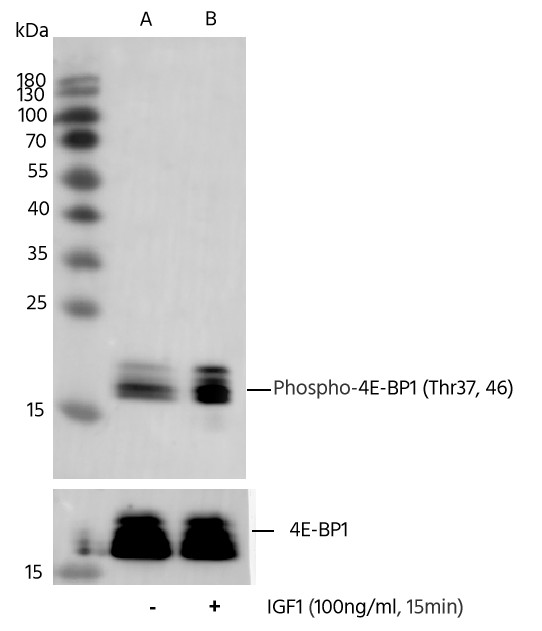 Recombinant Phospho-4E-BP1 (Thr37, 46) Monoclonal Antibody - small - 2