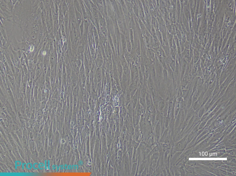 Human Keloid Fibroblast Complete Medium - 2