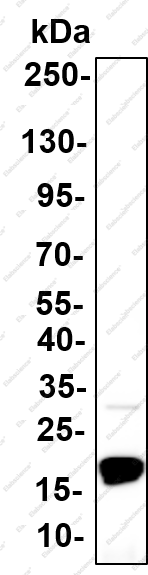 Recombinant Cystatin C Monoclonal Antibody - 1