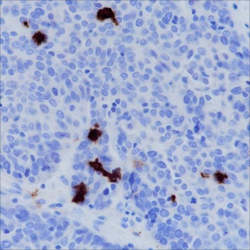 Recombinant CD1a Monoclonal Antibody - 3