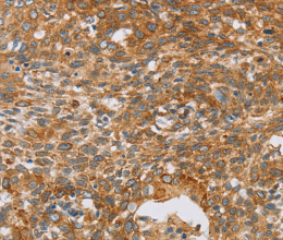 CRELD2 Polyclonal Antibody - 2