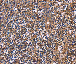 CLUAP1 Polyclonal Antibody - 3