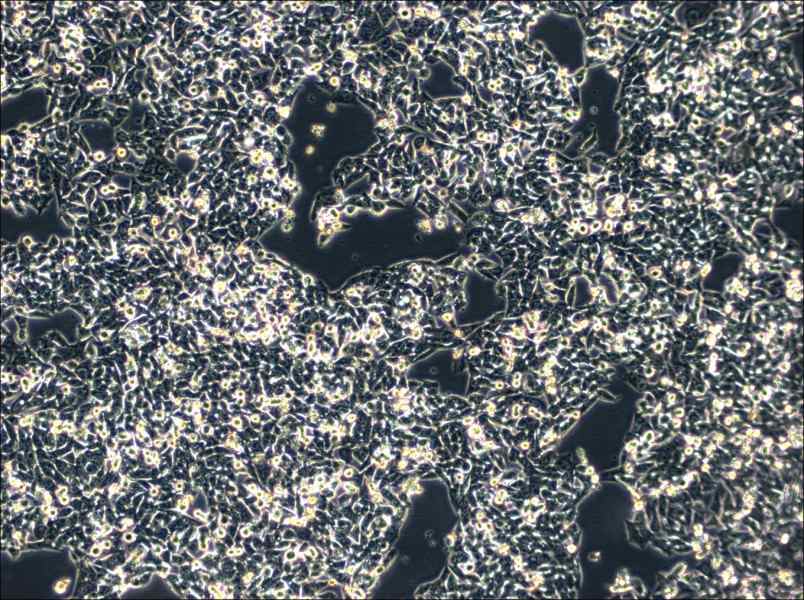 SK-CO-1 Cell Complete MediumSK-CO-1 Cell Complete Medium - 3