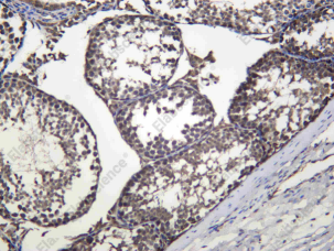Recombinant PCBP2 Monoclonal Antibody - 2