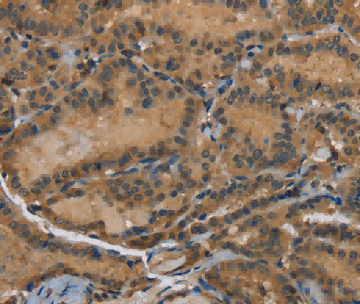 HSP40-4 Polyclonal Antibody - 3