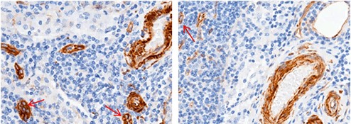Recombinant CD146/MCAM Monoclonal Antibody - small - 2