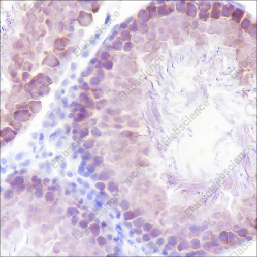Recombinant STIP1/STI1 Monoclonal Antibody - 3