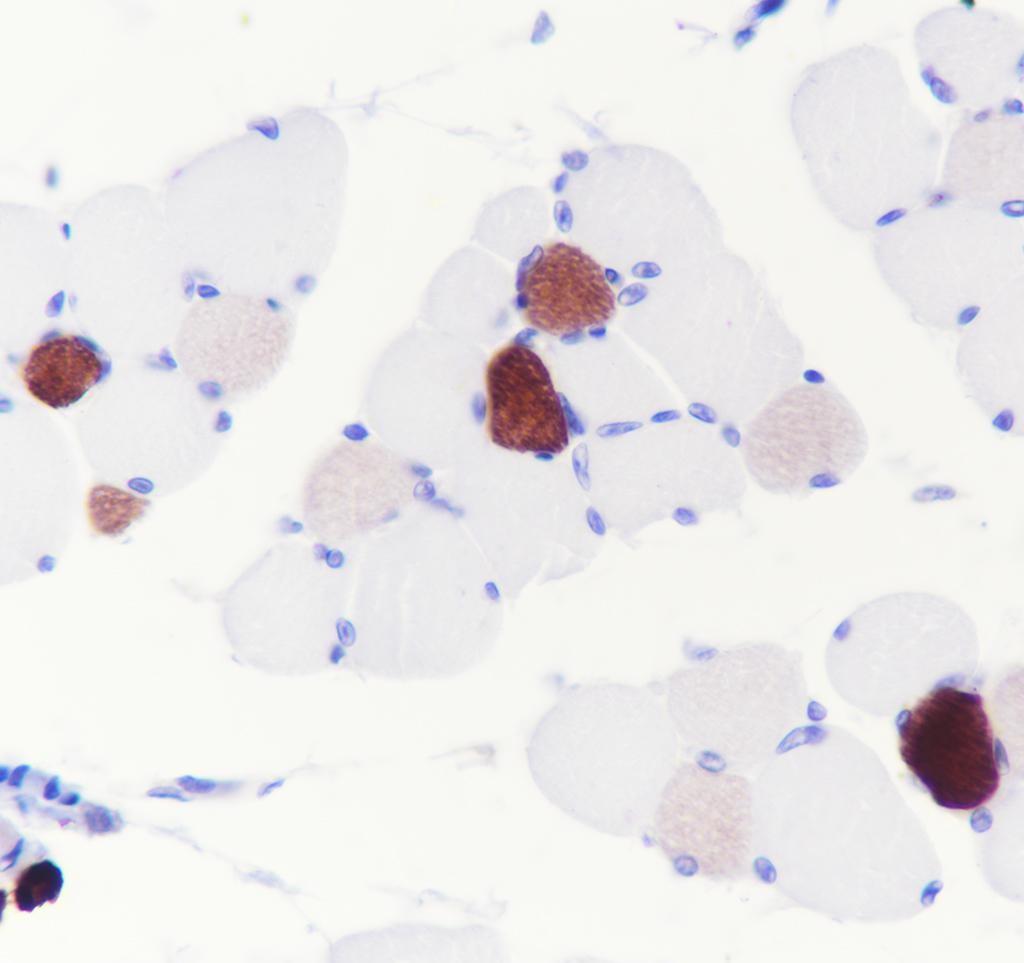 Recombinant MYH7 Monoclonal Antibody - small - 4