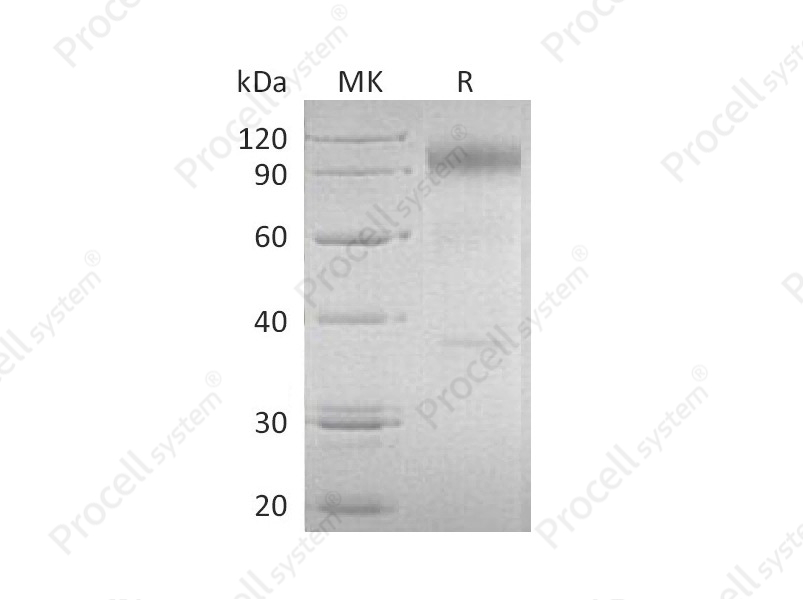 IL-23R (C-Fc), Human, Recombinant
