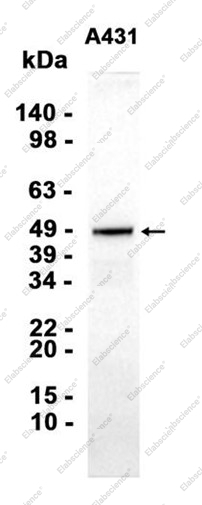 Recombinant HDAC3 Monoclonal Antibody - 1