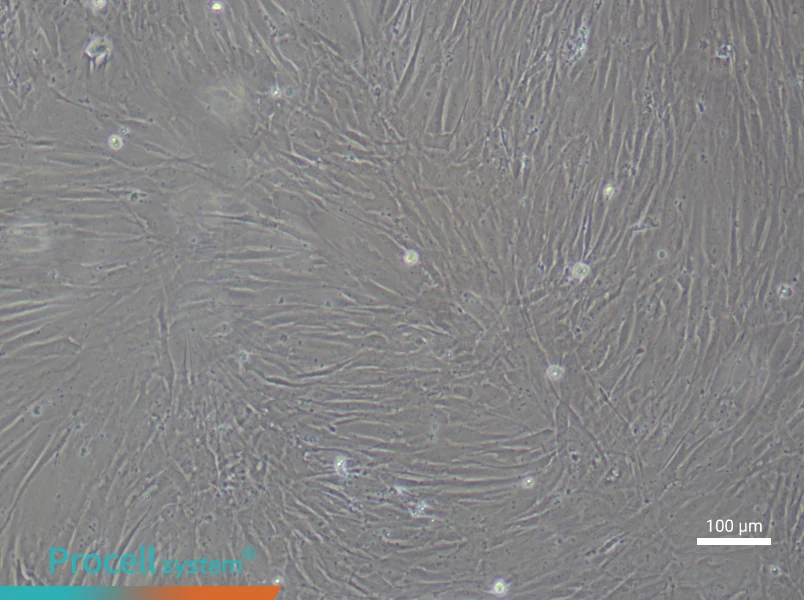 Human Sertoli (Primary cell immortalization) Cell Complete MediumHuman Sertoli (Primary cell immortalization) Cell Complete Medium - 2