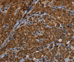 HSD17B13 Polyclonal Antibody - 2
