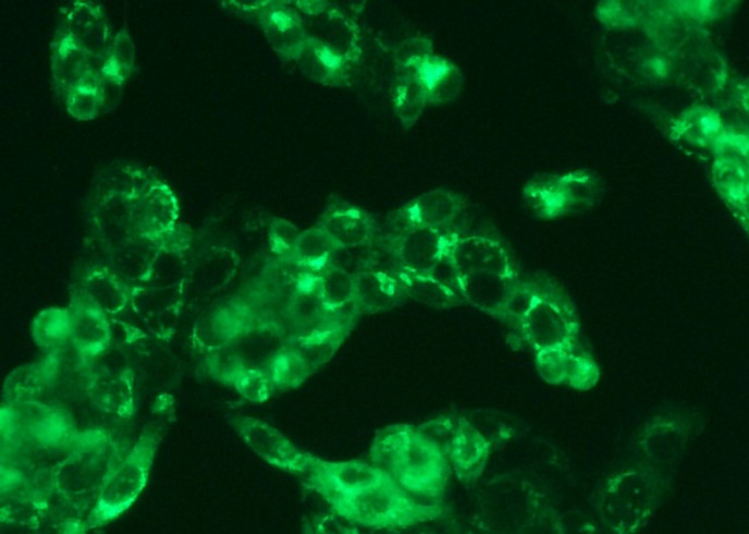 Recombinant Human Serum Albumin/HSA/ALB Monoclonal Antibody-searchlist-1