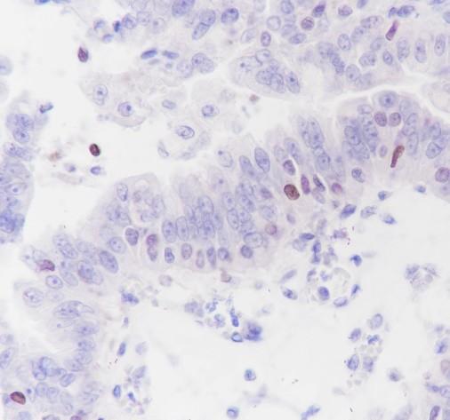 Recombinant SATB1 Monoclonal Antibody-searchlist-1